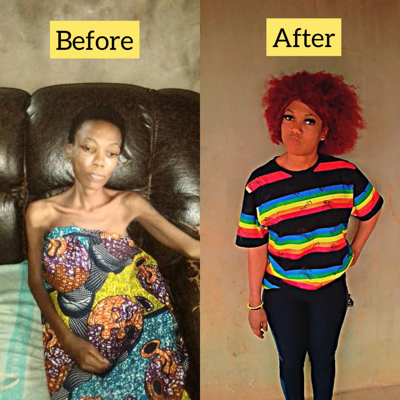 "Tuberculosis and HIV vanished" - Nigerian man narrates miraculous recovery of his sister who was dropped off by some people 6 years after she disappeared