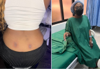 Lady lands in the hospital after getting a back dimple piercing